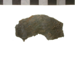 V15d7923 A16.160 x x uk zc_before_treatment x x.jpg